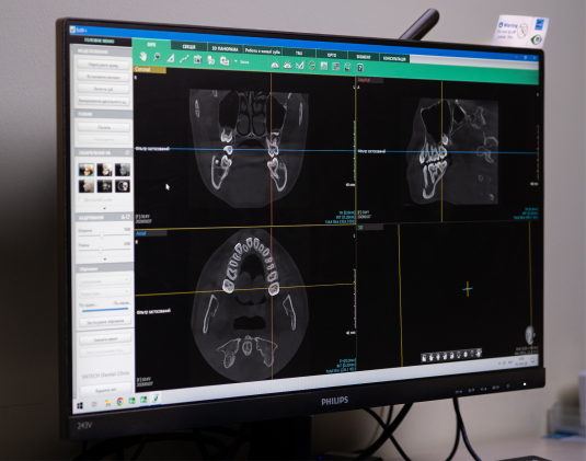 Комп'ютерна томографія фото