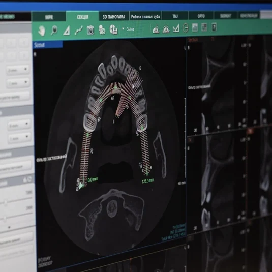 Повний чек-ап фото