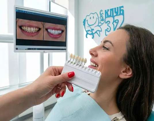 Ceramic veneers photo