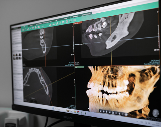 3D Computer tomography photo