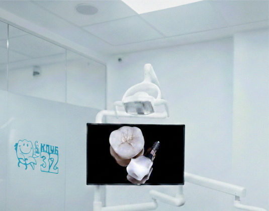 Zirconia crown on an implant photo