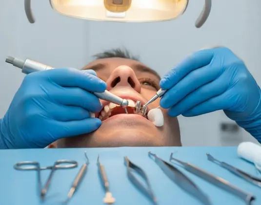 Upper tooth implantation photo