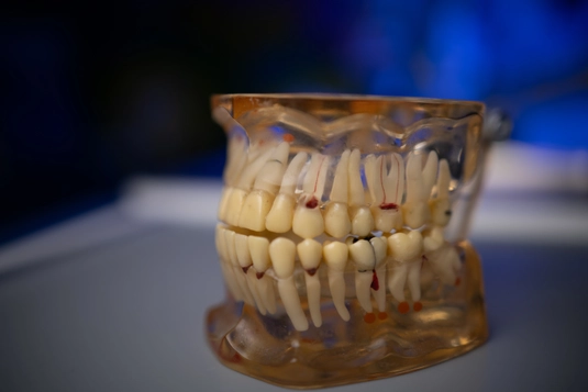 Root canal treatment photo