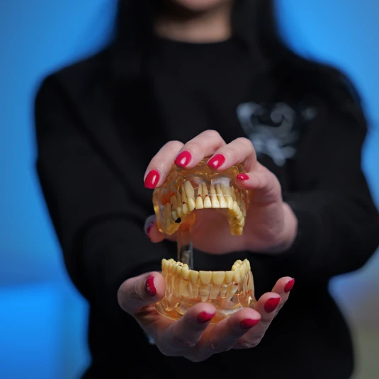 Implantation of all teeth photo