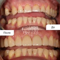“Спортивный” кейс
